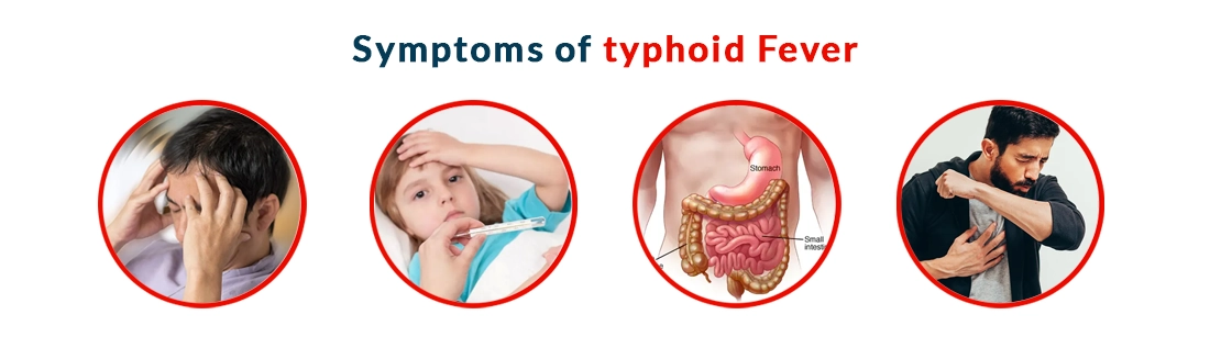 Symptoms of typhoid Fever